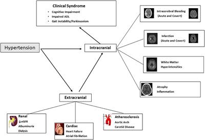 Hypertension and Cognitive Impairment: A Review of Mechanisms and Key Concepts